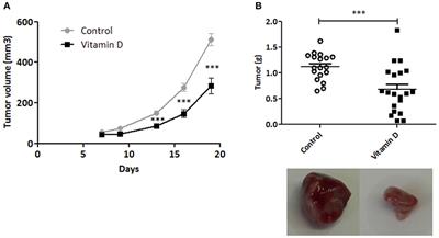 Vitamin D Controls Tumor Growth and CD8+ T Cell Infiltration in Breast Cancer